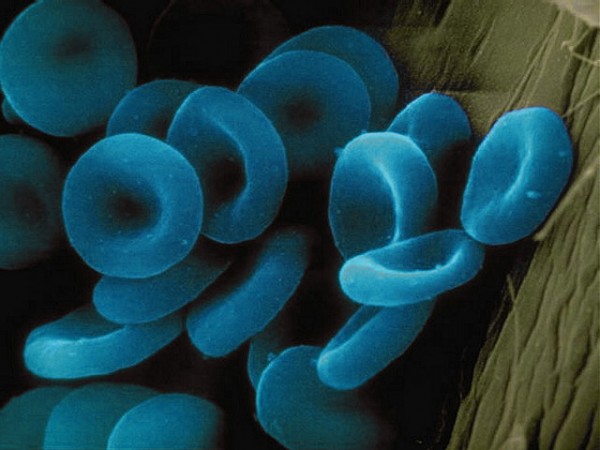 Blue Blood Cells