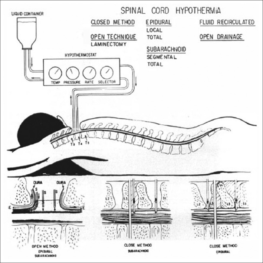 spinalcordheadtransplant