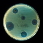 662px-Staphylococcus_aureus_(AB_Test)